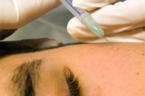En España médicos estéticos avalan la seguridad del Botox®