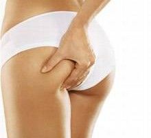 Lee más sobre el artículo Piernas fuertes y sanas sin celulitis