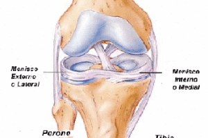 Lee más sobre el artículo Las lesiones de meniscos de la rodilla