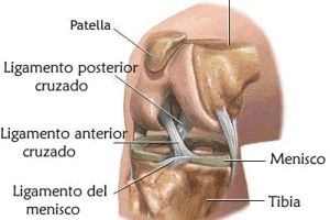 Lesión de ligamento cruzado anterior 2