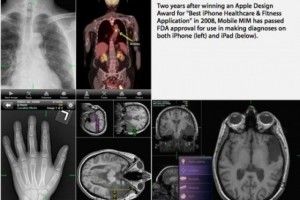 Lee más sobre el artículo Mobile MIM, una aplicación para uso clínico