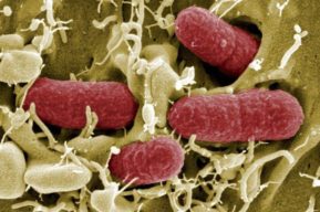 La escherichia coli, formas de prevenirla