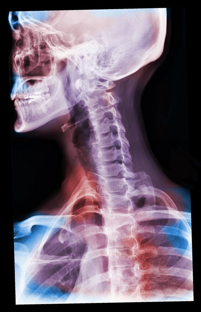Lee más sobre el artículo Lesiones en la cabeza y el cuello