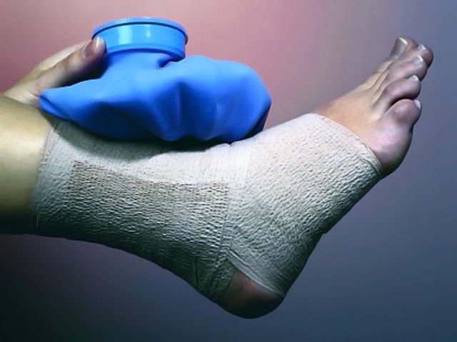 Lee más sobre el artículo La tendinitis del deportista, anatomía y prevención