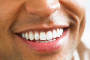 Unos dientes blancos para una sonrisa perfecta