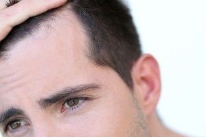 Lee más sobre el artículo Alopecia y microinjerto capilar
