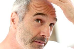 Lee más sobre el artículo Soluciones para la calvicie, cirugía estética